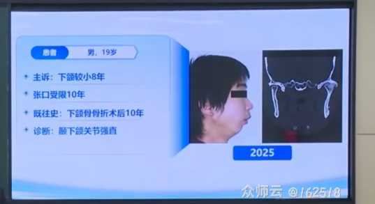 内容图片