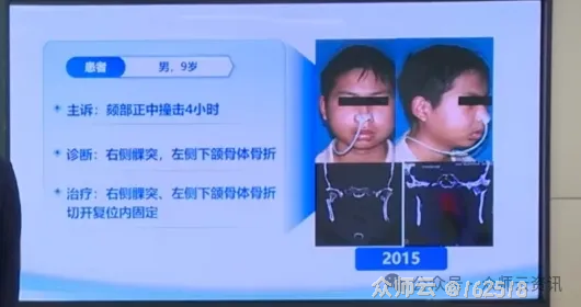 内容图片