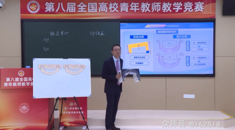 内容图片